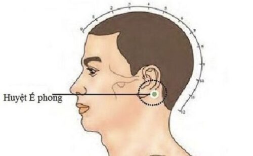 huyet e phong thumb 540x334 1